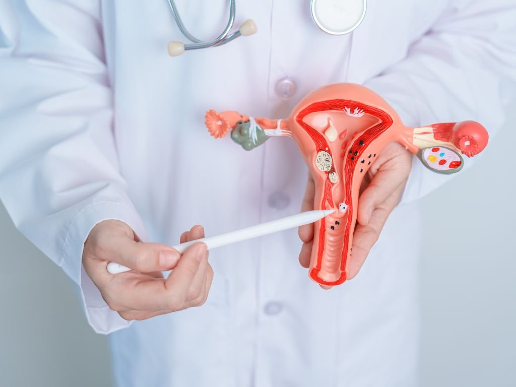Ovarian Cancer Treatment in Bangalore