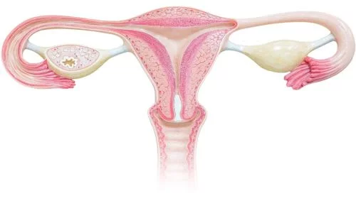 risk-factors-of-gynecological-cancer (1)