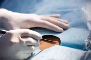 abnormal uterine bleeding symptoms