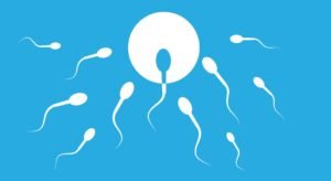 motility non progressive