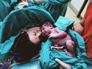 placenta after birth