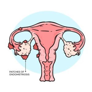 Endometrium