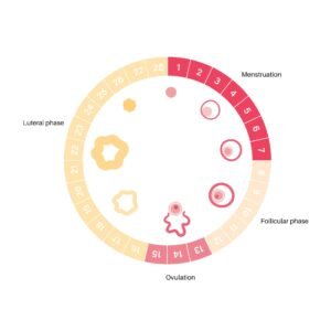 causes of short luteal phase 