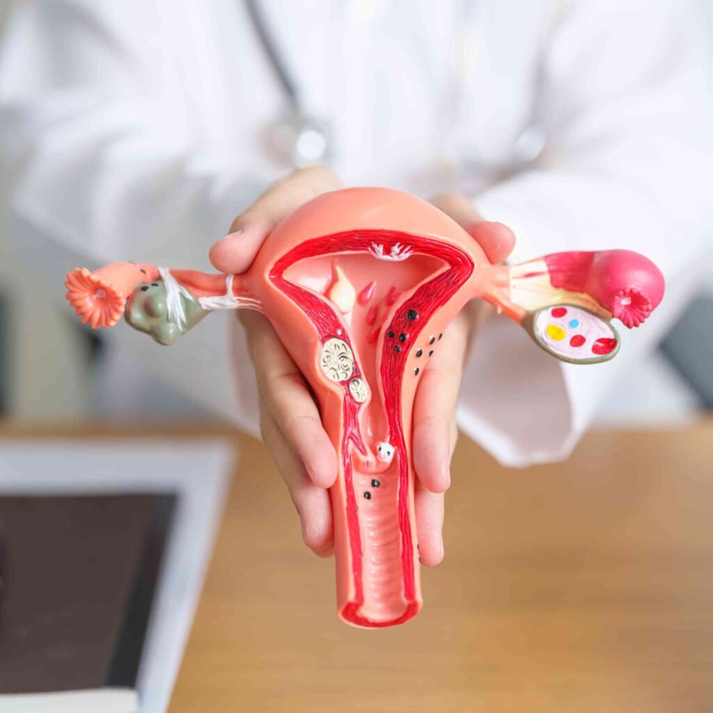 ovarian drilling