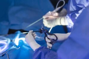 ovarian drilling procedure