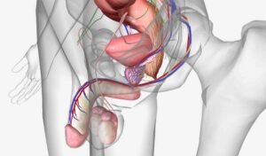varicocele surgery