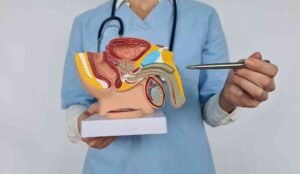 Varicocele