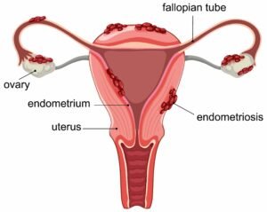 menstrual spotting after period