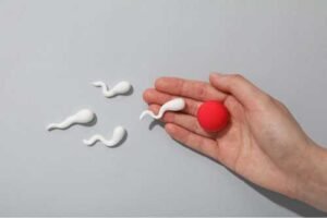 Male infertility effects of OVF