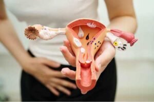 Fibroids and Fertility connection