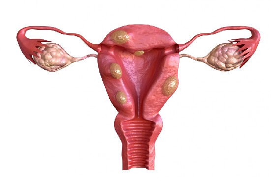 laparoscopic surgery cost in bangalore