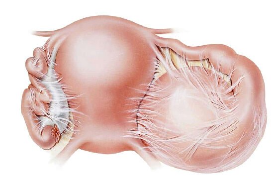 Laparoscopy treatment hospital in Bangalore