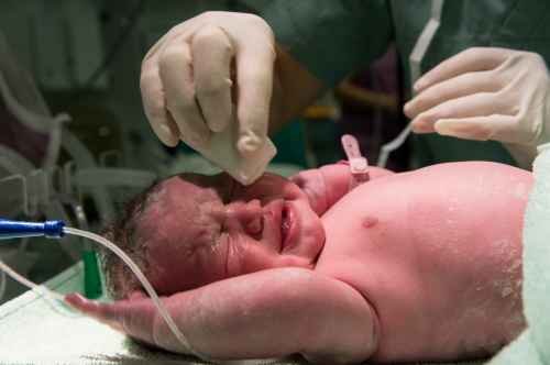 Advanced care for newborn health 