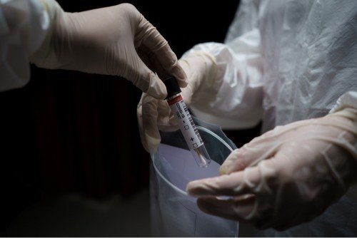 sperm retrieval for IVF or ICSI