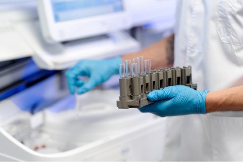 sperm retrieval for IVF or ICSI