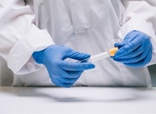 how is sperm retrieved for IVF or ICSI