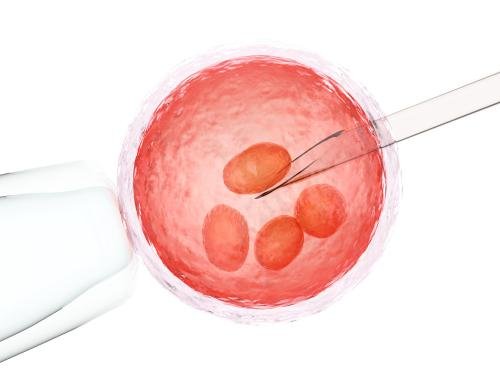 Can IVF Be Done Using Donor Sperm
